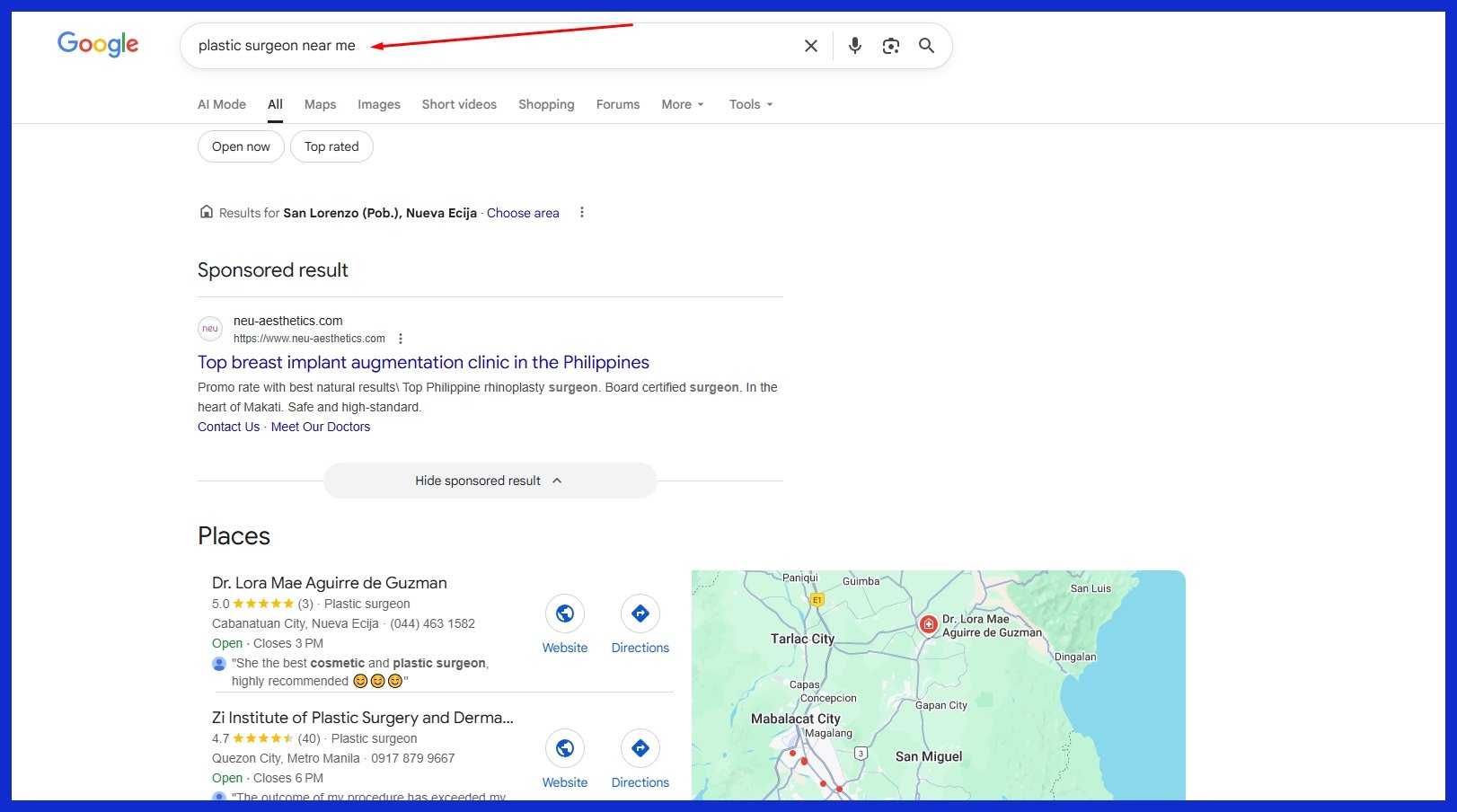 Why SEO for Plastic Surgeons?